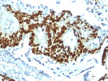 Recombinant Rabbit Monoclonal Antibody to p53 Tumor Suppressor Protein(Clone : TP53/1799R)