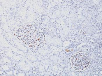 Recombinant Rabbit Monoclonal Antibody to Wilm's Tumor 1 (WT1) (Wilm's Tumor & Mesothelial Marker)(Clone : WT1/1434R)