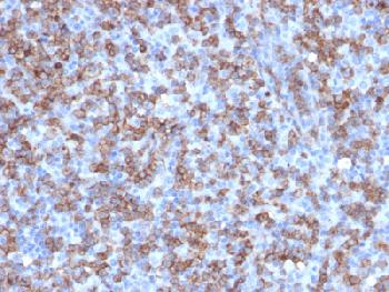 Recombinant Rabbit Monoclonal Antibody to CD8A (Cytotoxic- & Suppressor T-Cell Marker)(Clone : C8/1779R)