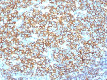 Recombinant Rabbit Monoclonal Antibody to CD20 / MS4A1 (B-Cell Marker)(Clone : IGEL/1497R)