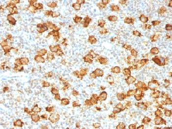 Recombinant Rabbit Monoclonal Antibody to CD30 / TNFRSF8 (Hodgkin & Reed-Sternberg Cell Marker)(Clone : Ki-1/1505R)