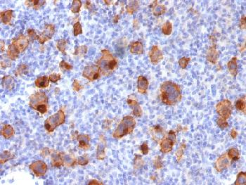 Recombinant Rabbit Monoclonal Antibody to CD30 / TNFRSF8 (Hodgkin & Reed-Sternberg Cell Marker)(Clone : Ki-1/1747R)