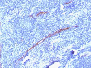 Recombinant Rabbit Monoclonal Antibody to CD34 (Hematopoietic Stem Cell & Endothelial Marker)(Clone : HPCA1/1806R)