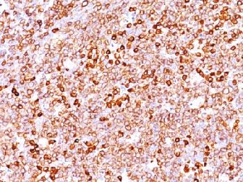 Recombinant Rabbit Monoclonal Antibody to CD79a(Clone : IGA/1688R)