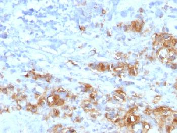 Recombinant Rabbit Monoclonal Antibody to CA19-9/Sialyl Lewisa (GI Tumor Marker)(Clone : CA19.9/1390R)