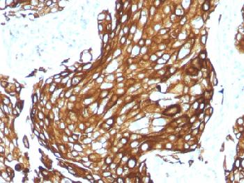 Recombinant Rabbit Monoclonal Antibody to  Cytokeratin, Acidic (Type I or LMW) (Epithelial Marker) (Clone : KRTL/1577R)