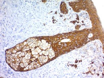 Recombinant Rabbit Monoclonal Antibody to  Cytokeratin, Basic (Type II or HMW) (Epithelial Marker) (Clone : KRTH/1576R)