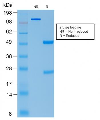 Anti-ACTH (Adrenocorticotrophic Hormone) (Pituitary Marker) Recombinant Mouse Monoclonal Antibody (Clone:rCLIP/1407)