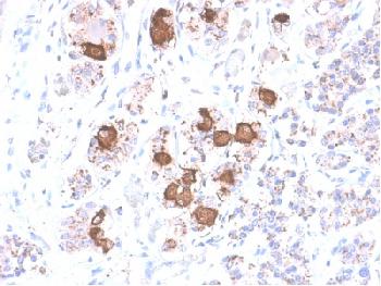 Anti-ACTH (Adrenocorticotrophic Hormone) (Pituitary Marker) Recombinant Rabbit Monoclonal Antibody (Clone:CLIP/2040R)