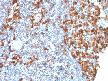 Anti-AIF1 / Iba1 (Microglia Marker) Recombinant Mouse Monoclonal Antibody (Clone:rAIF1/1909)