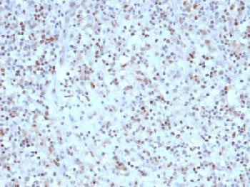 Anti-Bcl-6 (Follicular Lymphoma Marker) Recombinant Mouse Monoclonal Antibody (Clone:rBCL6/1527)