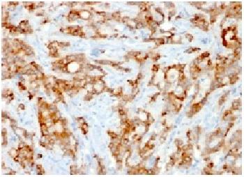 Anti-Beta-2 Microglobulin (Renal Failure &Tumor Marker) Recombinant Mouse Monoclonal Antibody (Clone:rB2M/961)