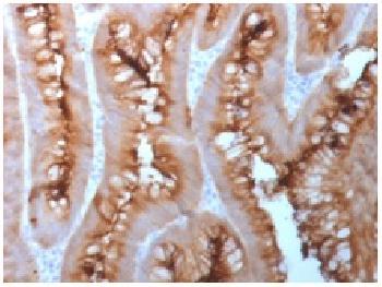 Anti-Carcinoembryonic Antigen (CEA) / CD66 Recombinant Mouse Monoclonal Antibody (Clone:C66/1983R)