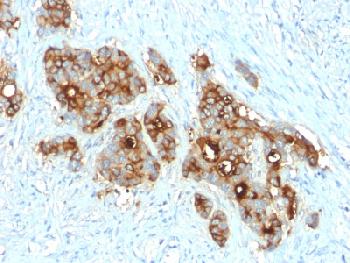 Anti-Carcinoembryonic Antigen (CEA) / CD66 Recombinant Rabbit Monoclonal Antibody (Clone:C66/2055R)