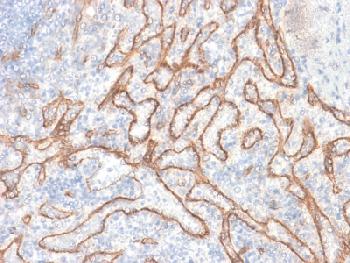 Anti-Catenin, beta (CTNNB1) Recombinant Rabbit Monoclonal Antibody (Clone:CTNNB1/2030R)