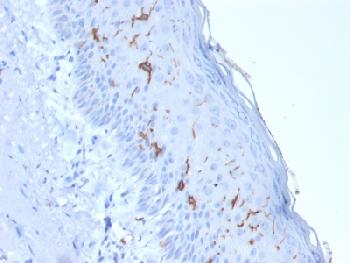 Anti-CD1a / HTA1 (Mature Langerhans Cells Marker) Recombinant Mouse Monoclonal Antibody (Clone:rC1A/711)