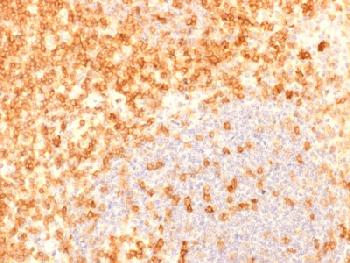 Anti-CD27 (Tumor Necrosis Factor Receptor Superfamily 7) Recombinant Mouse Monoclonal Antibody (Clone:rLPFS2/1611)