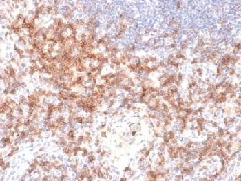 Anti-CD27 (Tumor Necrosis Factor Receptor Superfamily 7) Recombinant Rabbit Monoclonal Antibody (Clone:LPFS2/2034R)