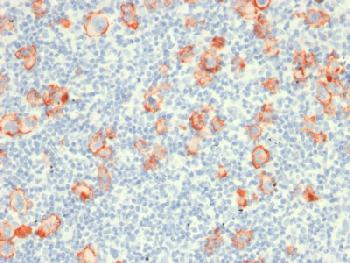 Anti-CD30 / TNFRSF8 (Hodgkin & Reed-Sternberg Cell Marker) Recombinant Mouse Monoclonal Antibody (Clone:rCD30/412)