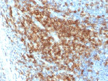 Anti-CD43 (T-Cell Marker) Recombinant Rabbit Monoclonal Antibody (Clone:SPN/2049R)