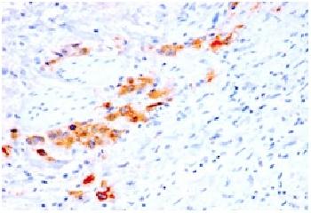 Anti-CD44v4 (Marker of Tumor Metastasis) Recombinant Mouse Monoclonal Antibody (Clone:rCD44v4/1219)