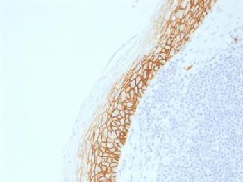 Anti-CD44v9 (Marker of Tumor Metastasis) Recombinant Rabbit Monoclonal Antibody (Clone:CD44v9/2344R)