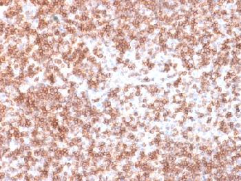 Anti-CD45 / LCA (B-Cell Marker) Recombinant Rabbit Monoclonal Antibody (Clone:PTPRC/1975R)