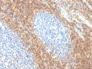 Anti-CD52 (Epididymis-Specific Protein 5) Recombinant Rabbit Monoclonal Antibody (Clone:CD52/2276R)