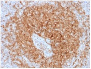 Anti-CD79a (B-Cell Marker) Recombinant Mouse Monoclonal Antibody (Clone:rIGA/764)