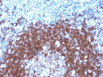 Anti-CD79a (B-Cell Marker) Recombinant Rabbit Monoclonal Antibody (Clone:IGA/1790R)