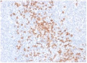 Anti-CD8A (Cytotoxic-&Suppressor T-Cell Marker) Recombinant Mouse Monoclonal Antibody (Clone:rC8/468)