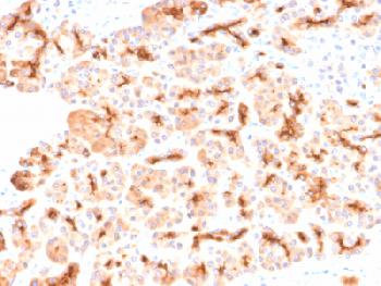 Anti-CFTR (Cystic Fibrosis Transmembrane Conductance Regulator) Recombinant Rabbit Monoclonal Antibody (Clone:CFTR/2290R)