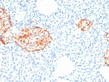 Anti-Chromogranin A / CHGA (Neuroendocrine Marker) Recombinant Mouse Monoclonal Antibody (Clone:rCHGA/798)