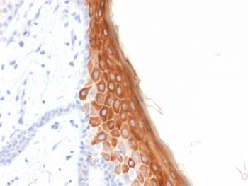 Anti-Cytokeratin 10 (KRT10) (Suprabasal Epithelial Marker) Recombinant Mouse Monoclonal Antibody (Clone:rKRT10/844)