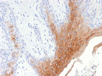 Anti-Cytokeratin 10 (KRT10) (Suprabasal Epithelial Marker) Recombinant Rabbit Monoclonal Antibody (Clone:KRT10/1990R)