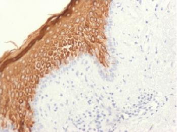 Anti-Cytokeratin 10 (Suprabasal Epithelial Marker) Recombinant Rabbit Monoclonal Antibody (Clone:KRT10/1948R)