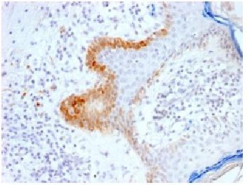 Anti-Cytokeratin 15 (KRT15) (Basal Cell Marker) Recombinant Rabbit Monoclonal Antibody (Clone:KRT15/2103R)