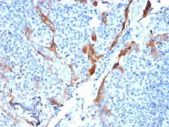 Anti-Cytokeratin 16 (KRT16) (Suprabasal Keratinocyte Marker) Recombinant Mouse Monoclonal Antibody (Clone:KRT16/1714)