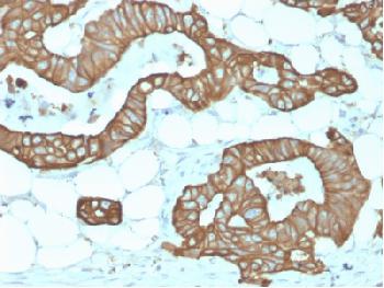 Anti-Cytokeratin 19 (KRT19) (Pancreatic Stem Cell Marker) Recombinant Rabbit Monoclonal Antibody (Clone:KRT19/1959R)