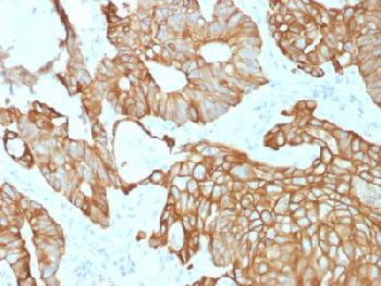 Anti-Cytokeratin 19 (Pancreatic Stem Cell Marker) Recombinant Mouse Monoclonal Antibody (Clone:rKRT19/800)