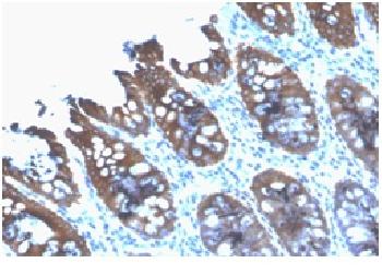 Anti-Cytokeratin 8 (KRT8) Recombinant Mouse Monoclonal Antibody (Clone:rB22.1)