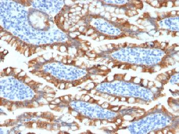 Anti-Cytokeratin 8 (KRT8) Recombinant Rabbit Monoclonal Antibody (Clone:KRT8/2174R)