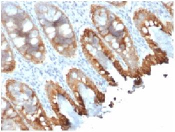 Anti-Cytokeratin 8/18 Recombinant Mouse Monoclonal Antibody (Clone:rKRT8.18/1346)