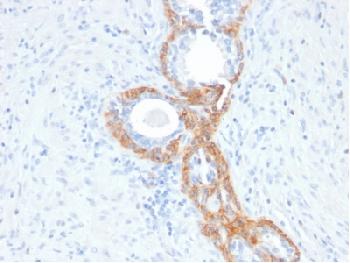 Anti-Cytokeratin, Basic (Type II or HMW) Recombinant Mouse Monoclonal Antibody (Clone:rKRTH/2148)