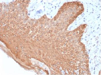 Anti-Cytokeratin, Multi (Epithelial Marker) Recombinant Mouse Monoclonal Antibody (Clone:rKRT/457)