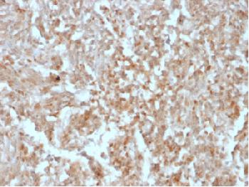 Anti-DOG-1/TMEM16A (Gastrointestinal Stromal Tumor Marker) Recombinant Mouse Monoclonal Antibody (Clone:rDG1/447)