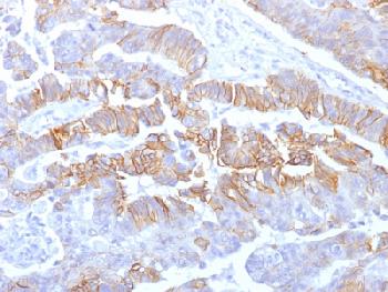 Anti-E-Cadherin (CDH1) / CD324 (Intercellular Junction Marker) Recombinant Mouse Monoclonal Antibody (Clone:rCDH1/1525)