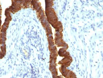 Anti-Ep-CAM / CD326 (Epithelial Marker) Recombinant Mouse Monoclonal Antibody (Clone:rEGP40/1110)