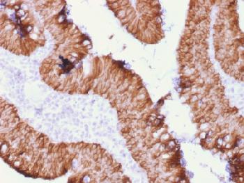 Anti-Ep-CAM / CD326 (Extracellular Domain) (Epithelial Marker) Recombinant Mouse Monoclonal Antibody (Clone:rEGP40/1372)