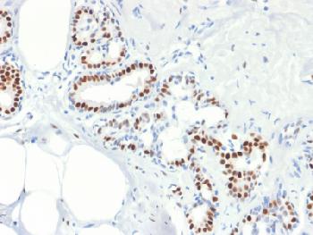 Anti-Estrogen Receptor, alpha (Marker of Estrogen Dependence) Recombinant Mouse Monoclonal Antibody (Clone:rESR1/1935)